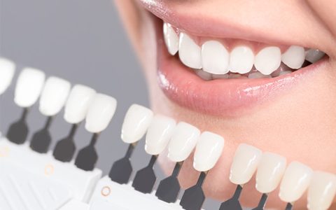Blanqueamiento Dental en Talcahuano